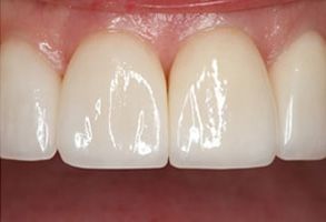 Dentistry With Comfort | Dentures, TMJ Disorders and Digital Radiography