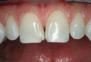Dentistry With Comfort | TMJ Disorders, Digital Radiography and Snoring Appliances